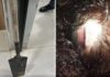 Mulher tem dedo quebrado e sofre cortes na cabeça após ser agredida com pá por homem