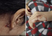 Pai de menina esfaqueada dentro de sala de aula diz que filha não quer voltar à escola